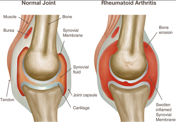 Home Remedy For Dog Sore Joints Home Remedy For Dog Sore Joints