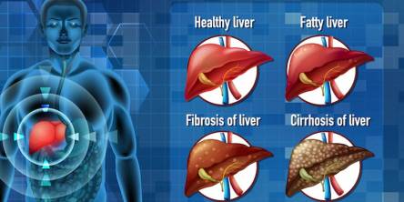 symptoms of liver disease