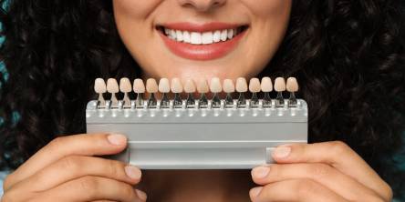 How Veneers Can Transform Your Teeth and Boost Confidence