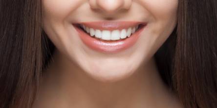 6 Effective Treatments for a Gummy Smile 
