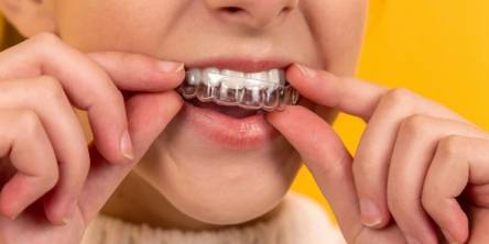 7 Weighty Reasons to Visit an Orthodontist
