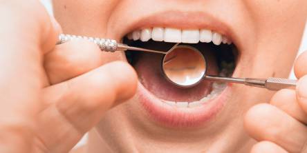 Assessing Your Risk of Gum Disease