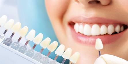 Debunking the Top 7 Myths About Cosmetic Dentistry
