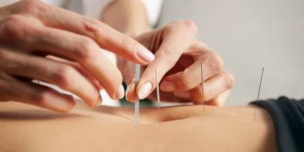 7 Awesome Health Benefits of Acupuncture That Will Surprise You