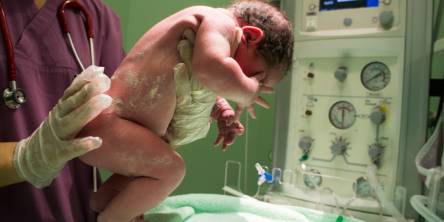 Baby Circumcision