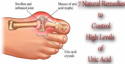 7 Natural Remedies to Control High Levels of Uric Acid