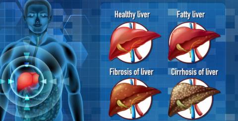 symptoms of liver disease