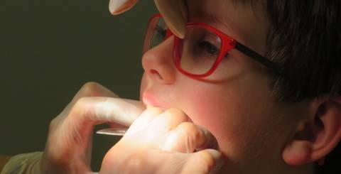 How do Invisalign Braces Work? How do Invisalign Braces Work?