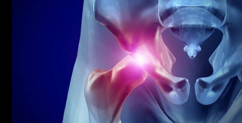 Sciatic nerve treatment Sciatic nerve treatment
