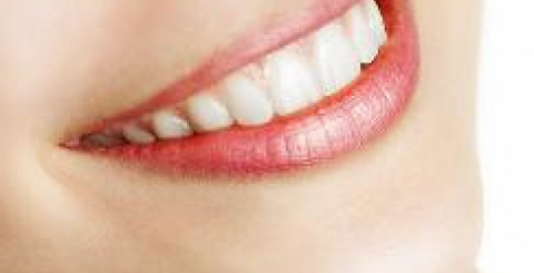 Teeth whitening dubai Dental clinic dubai