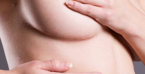 5 Ways to Reduce the Visibility of Breast Lift Scars