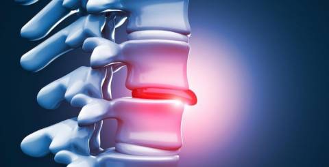 Herniated Disc Treatments: Comparing Non-Surgical and Surgical Options Herniated Disc Treatments: Comparing Non-Surgical and Surgical Options
