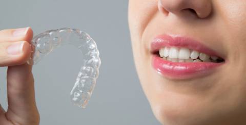 How to Decide If Adult Invisible Braces Are for You