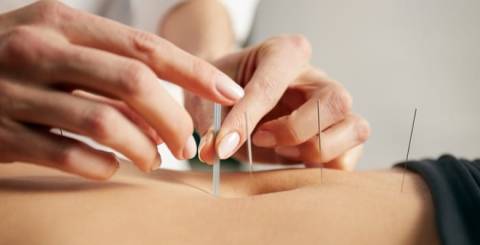 7 Awesome Health Benefits of Acupuncture That Will Surprise You 7 Awesome Health Benefits of Acupuncture That Will Surprise You