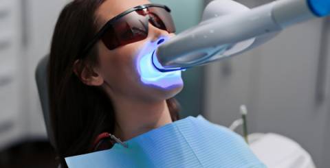 Pros and Cons of Laser Teeth Whitening