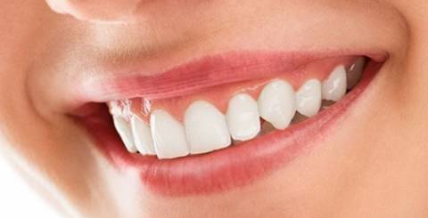 What Can Be Included Into a Smile Makeover? What Can Be Included Into a Smile Makeover?