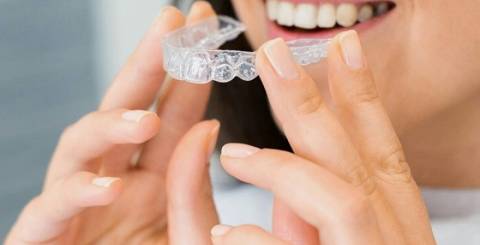 What Is the Difference Between Invisalign and Damon Braces?