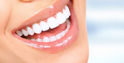 Why At-Home Glo Teeth Whitening Is Not the Best Idea