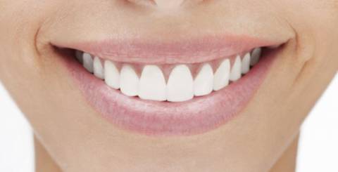 smile teeth white