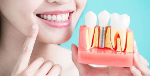 7 Reasons Why Dental Implants Are Best Solutions for Missing Teeth 7 Reasons Why Dental Implants Are Best Solutions for Missing Teeth