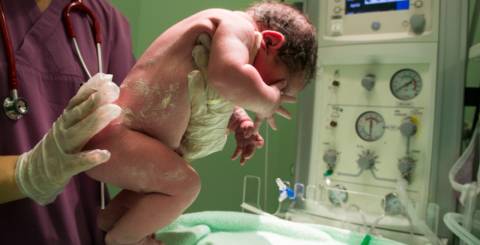 Baby Circumcision Baby Circumcision