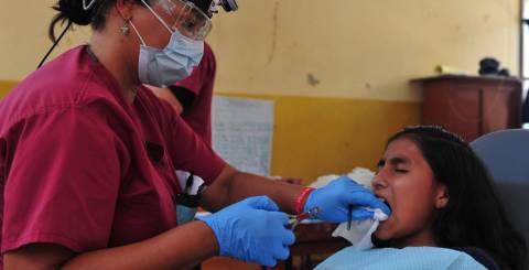 Tooth Extraction Tooth Extraction