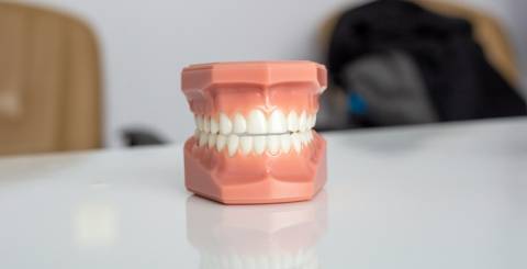 Teeth whitening Teeth whitening
